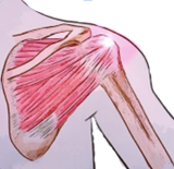 Drawing of the tendons in a shoulder, showing the position of Adhesive Capsulitis