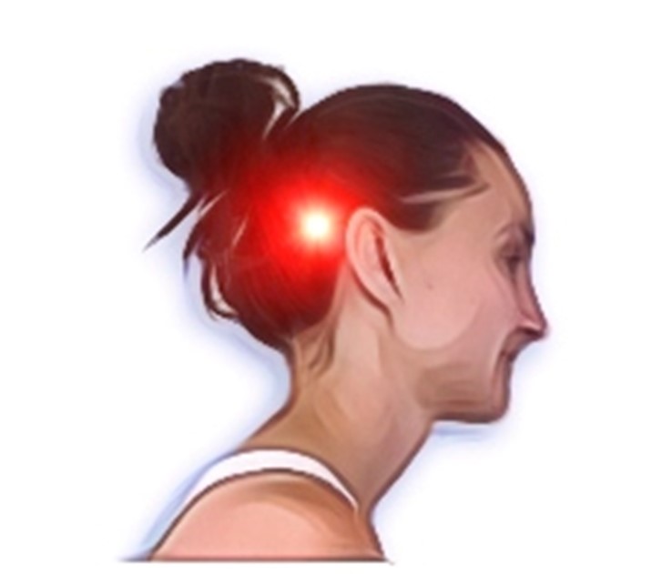 An illustration of a person's head, with a red glow on their head, indicating headache pain
